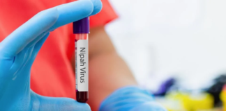 Emiten alerta epidemiológica en India por brote del virus Nipah