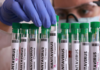 Emite salud aviso epidemiológico por el brote de hantavirus