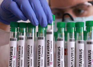 Emite salud aviso epidemiológico por el brote de hantavirus